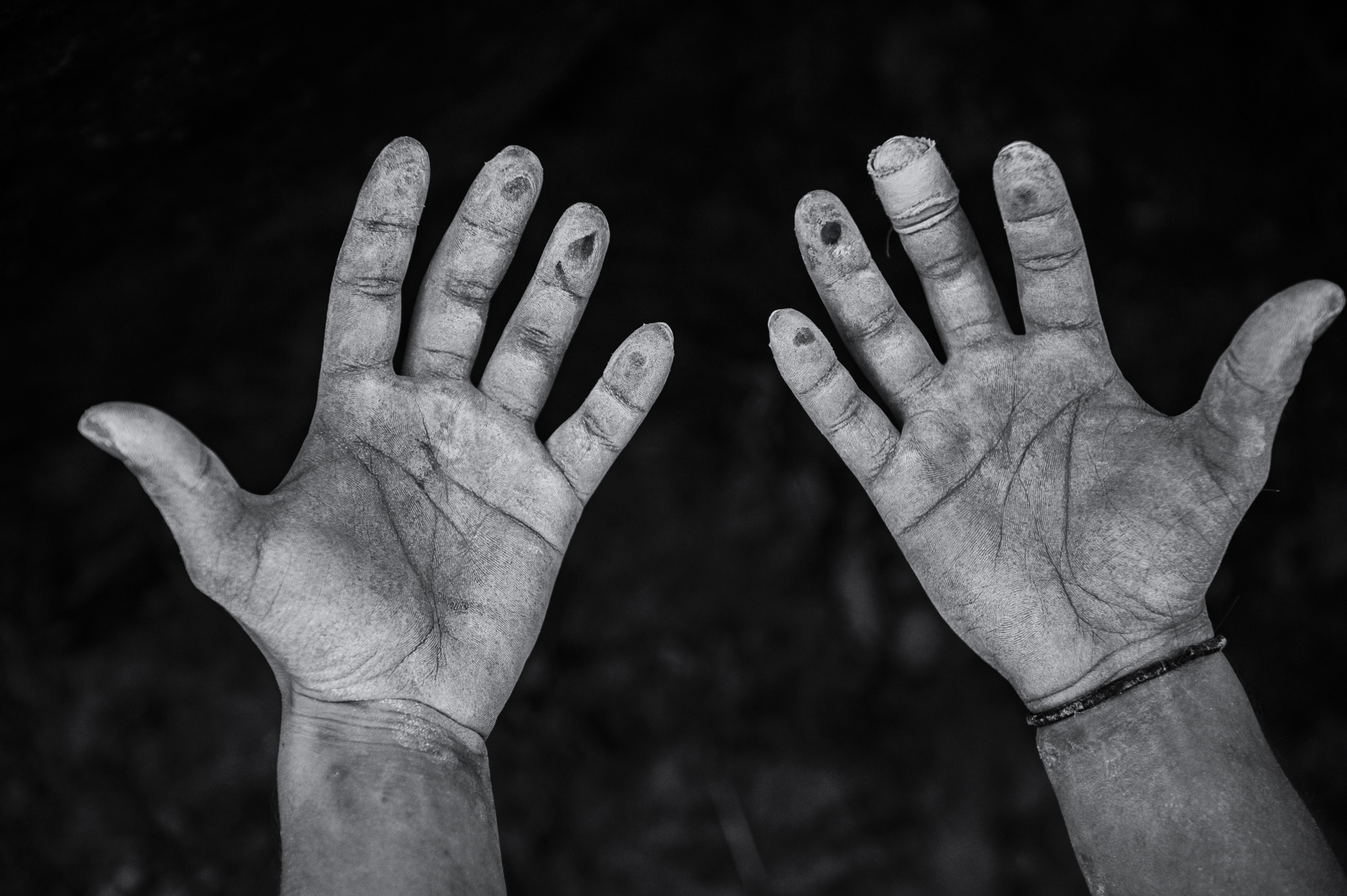 Hands torn from climbing